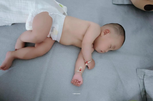 盘锦宝宝头上长痱子 盘锦宝宝头上长痱子